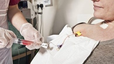 هل يشفى مريض السرطان بعد الكيماوي اكتشف الحقيقة المدهشة والدروس المستفادة! 4 5 1